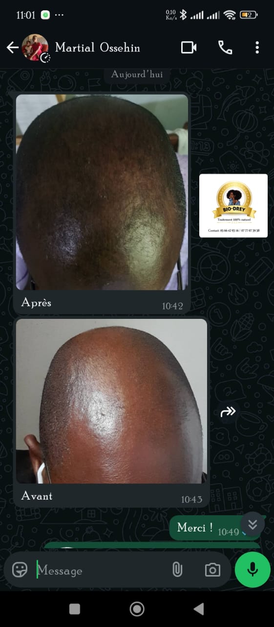 Avant / Après